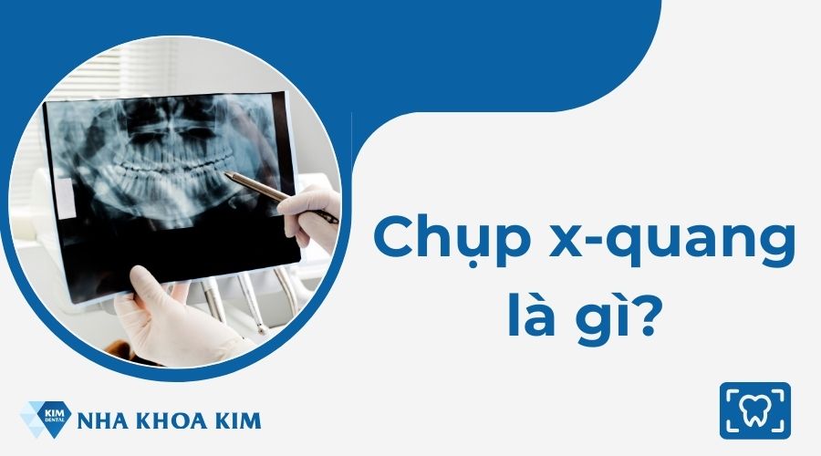 Chụp X-quang là gì?