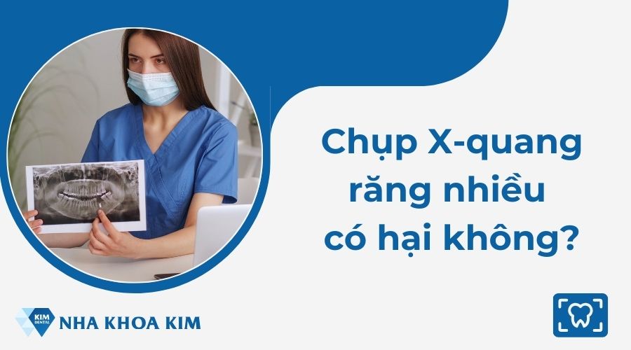Chụp X-quang răng nhiều có hại không?