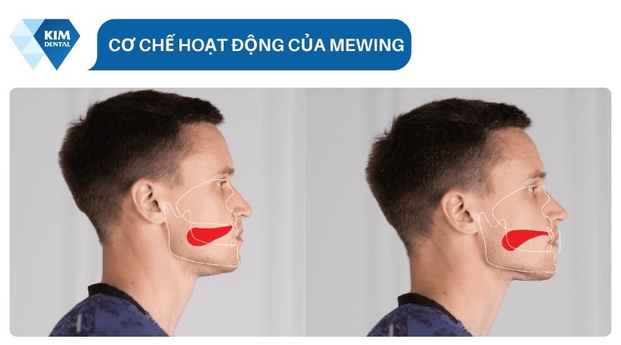 Cơ chế hoạt động của Mewing