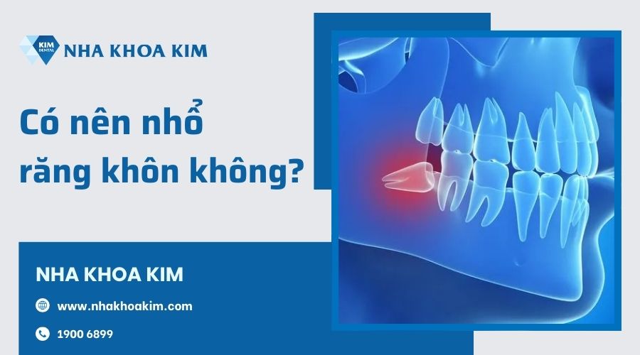 Có nên nhổ bỏ răng khôn không?