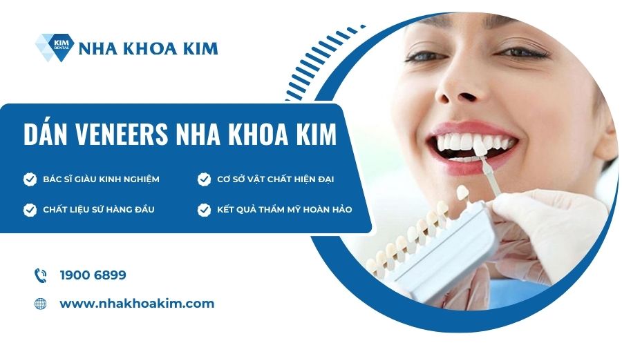 Địa chỉ dán veneers an toàn, uy tín