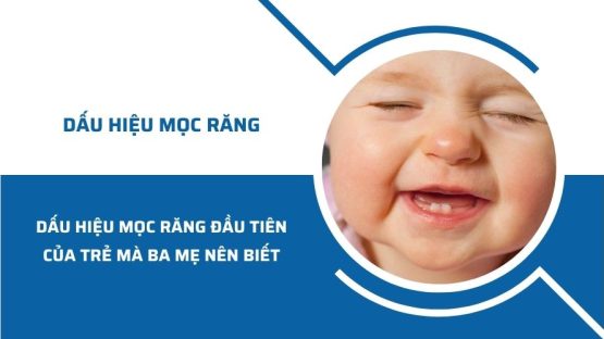 Những dấu hiệu mọc răng đầu tiên của trẻ mà ba mẹ nên biết