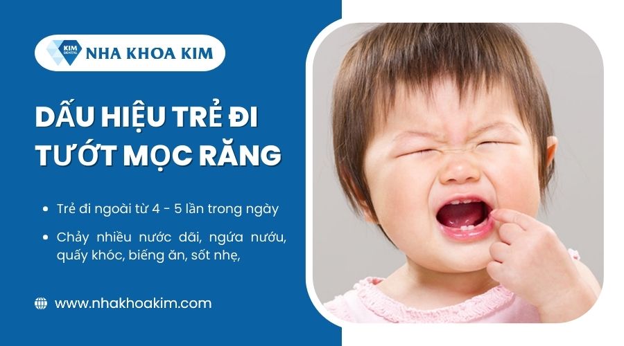 Dấu hiệu trẻ đi tướt mọc răng