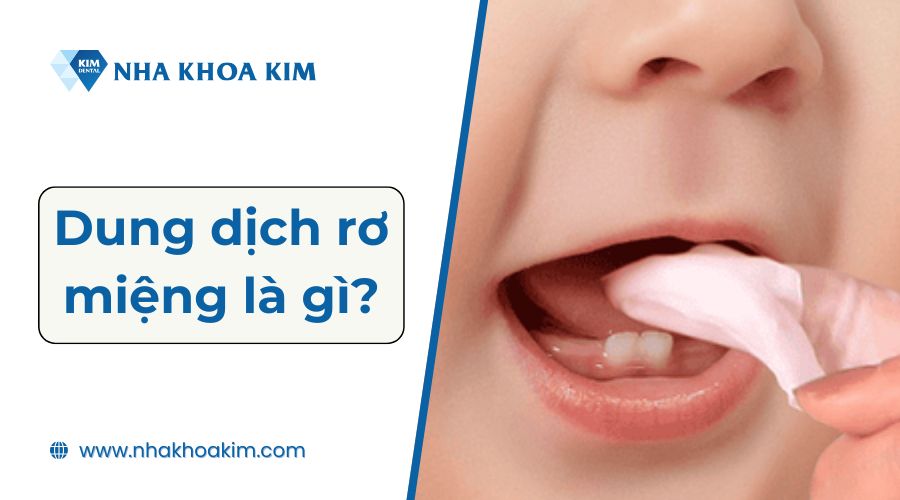 Dung dịch rơ miệng là gì?