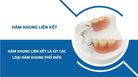 Hàm khung liên kết là gì? Các loại hàm khung phổ biến