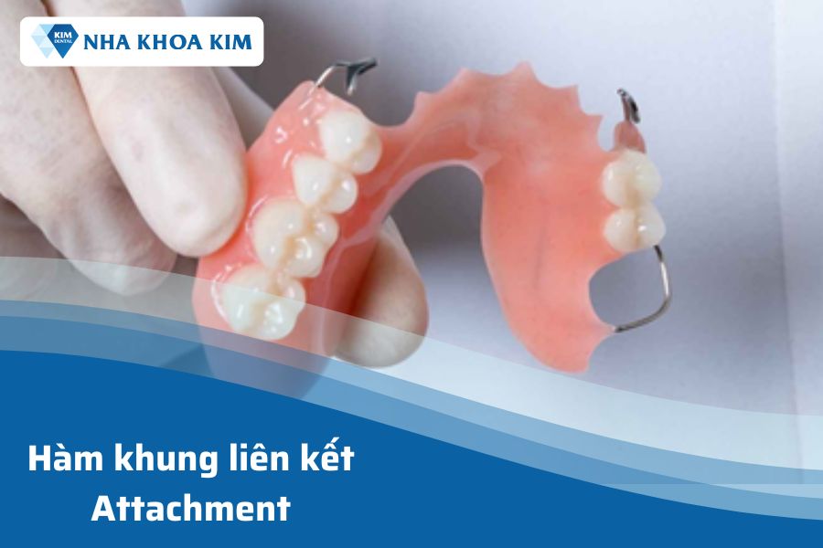 Hàm khung liên kết Attachment