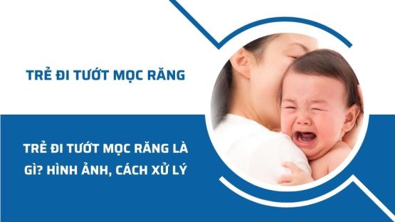 Trẻ đi tướt mọc răng là gì? Hình ảnh nhận biết và cách xử lý