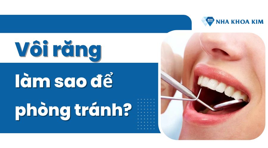 Làm sao để không bị vôi răng?