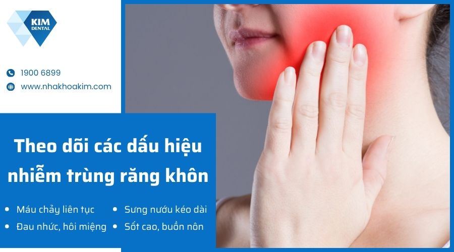 Lưu ý chăm sóc sau khi nhổ răng khôn