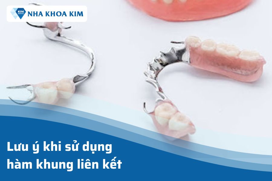 Lưu ý khi sử dụng hàm khung liên kết