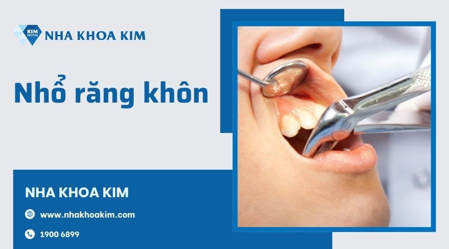 Nhổ răng khôn như thế nào?