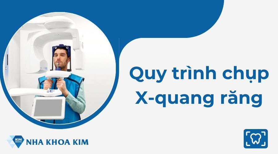 Mô phỏng quy trình chụp X-quang răng