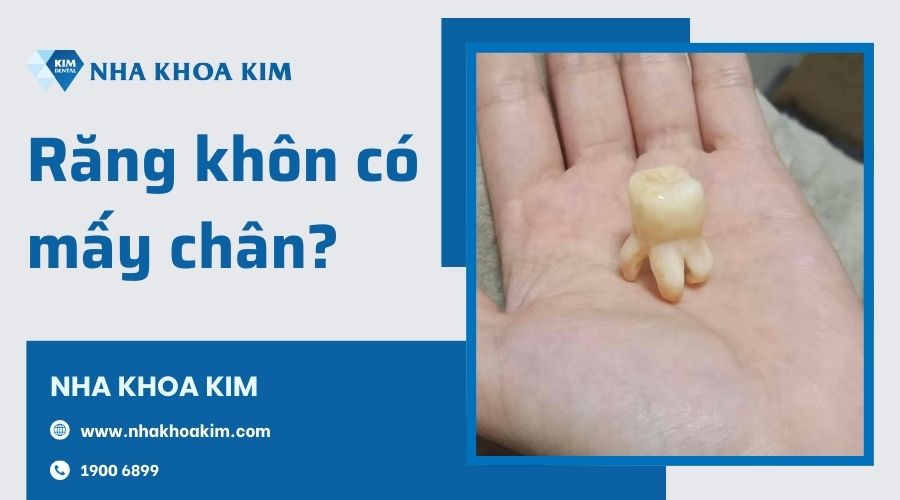 Răng khôn có mấy chân?