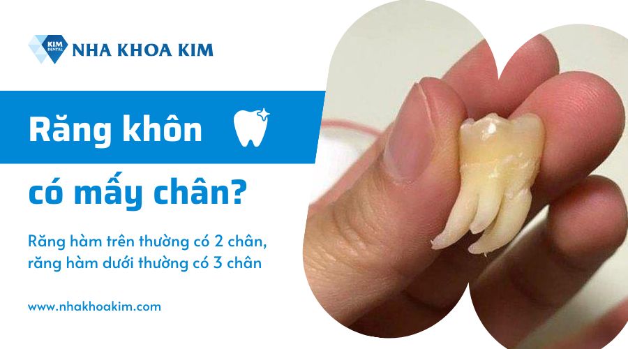 Răng khôn có mấy chân?