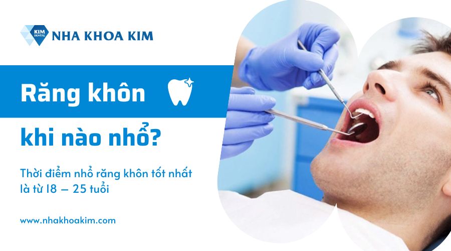 Thời điểm nhổ răng khôn?