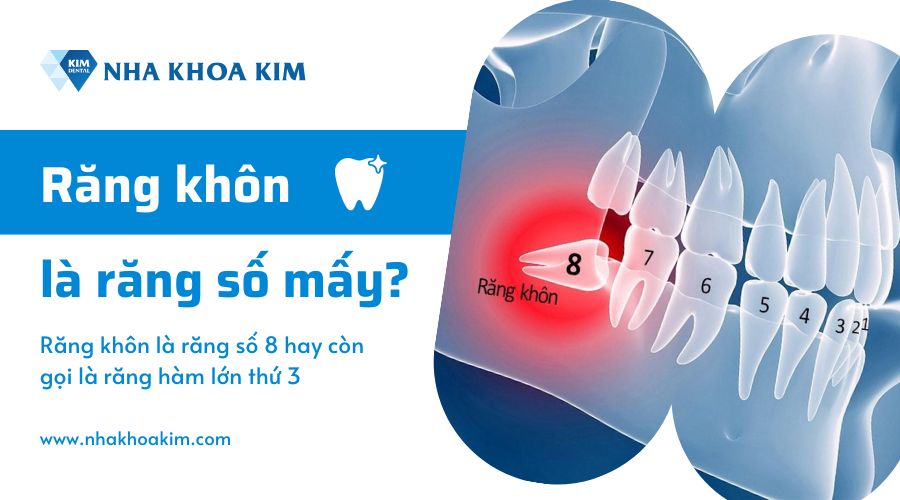 Răng khôn là răng số mấy?