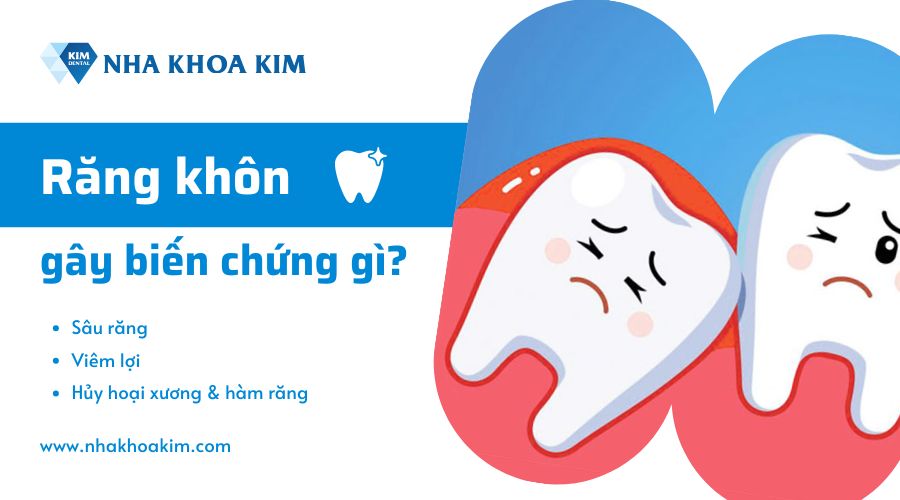 Biến chứng răng khôn gây ra là gì?
