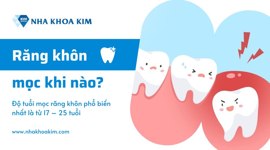 Răng khôn mọc khi nào?