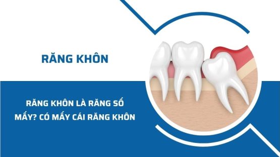 Răng khôn là răng số mấy? Một người có mấy cái răng khôn?