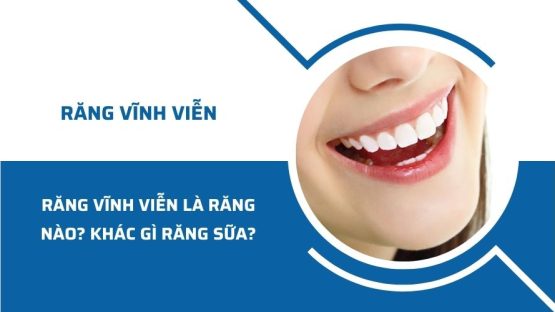 Răng vĩnh viễn là răng nào? Răng vĩnh viễn khác gì răng sữa?