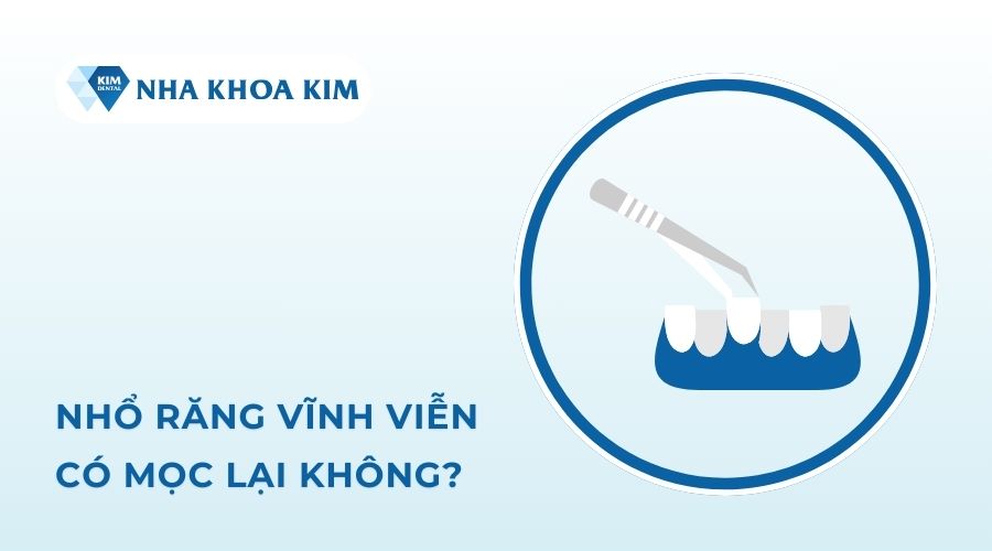 Nhổ răng vĩnh viễn có mọc lại không?