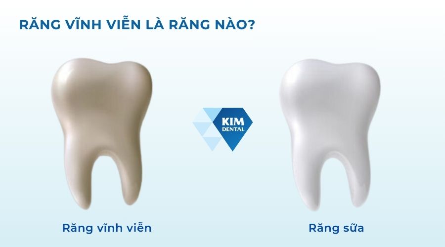 Răng vĩnh viễn là răng nào?