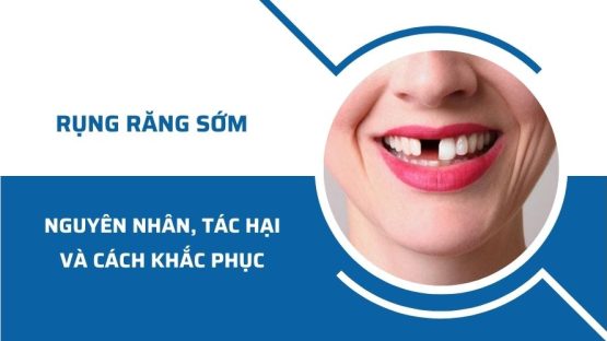 Rụng răng sớm: Nguyên nhân, tác hại và cách khắc phục