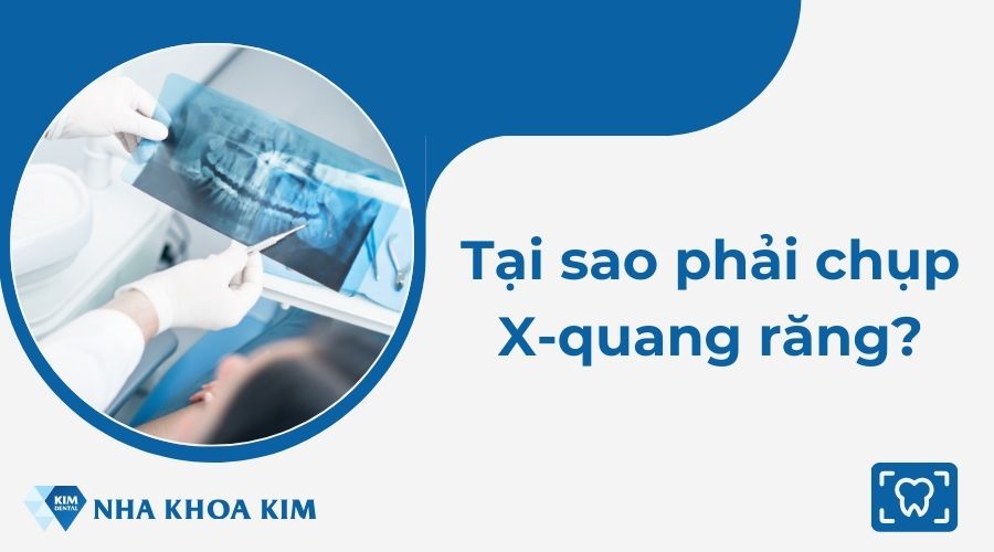 Tại sao phải chụp X-quang răng?