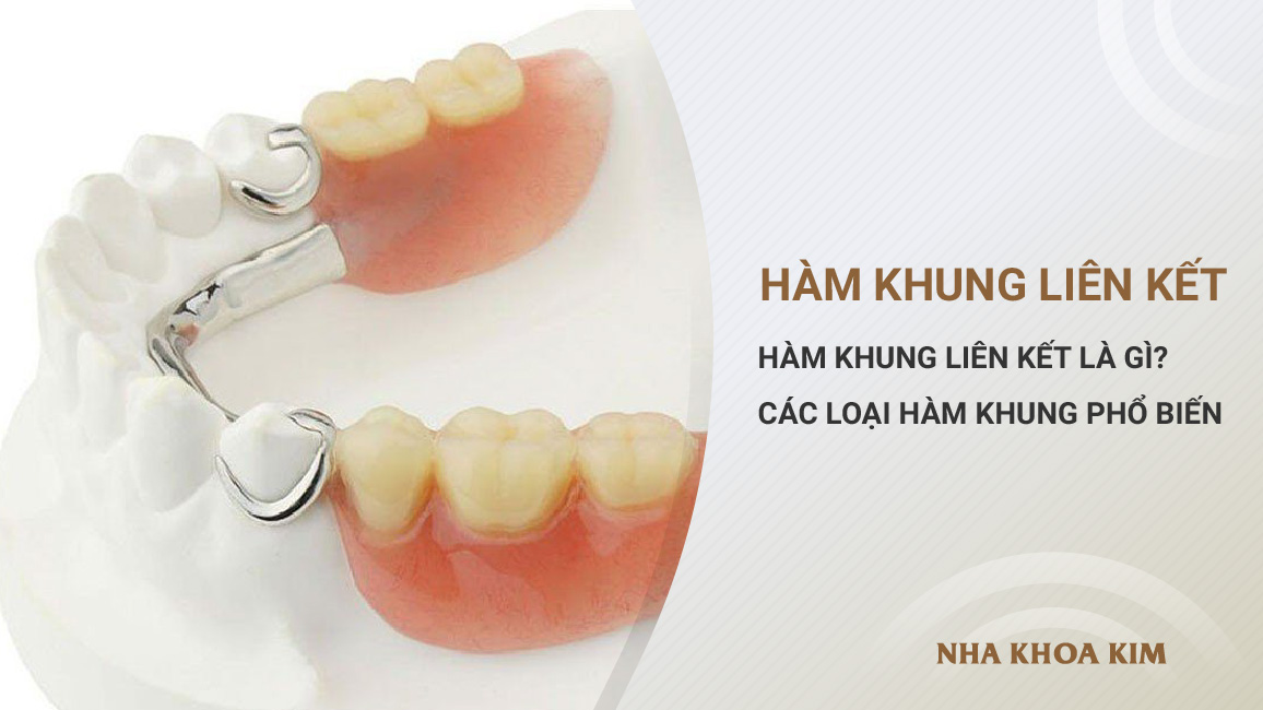 Hàm khung liên kết là gì? Các loại hàm khung phổ biến