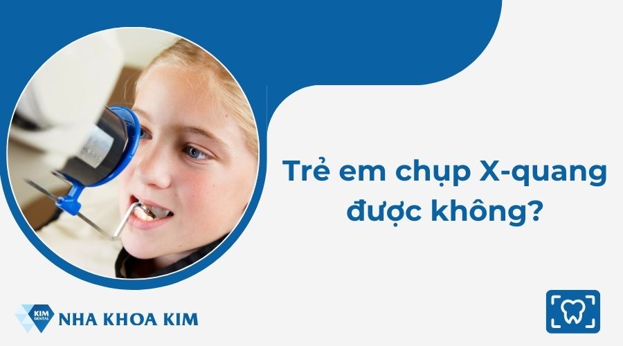 Trẻ em chụp X-quang được không?