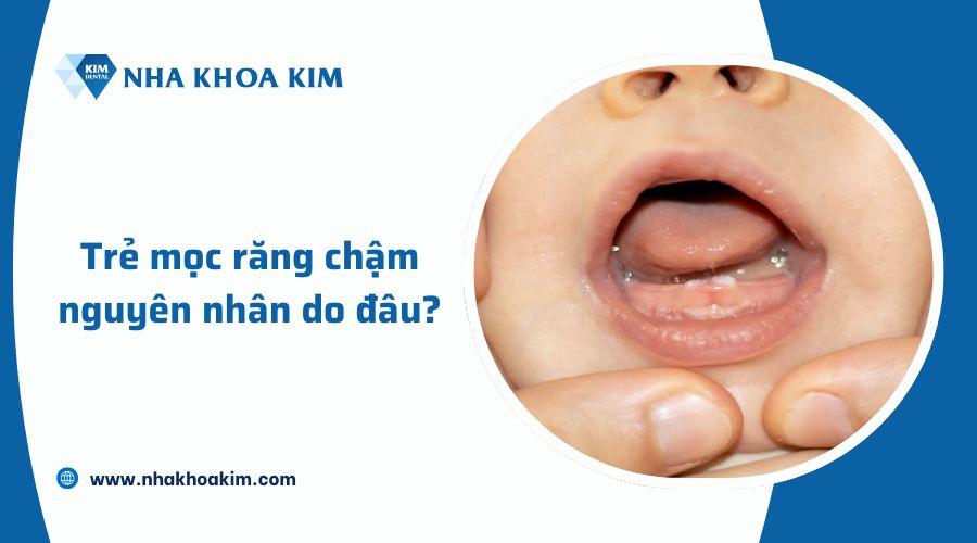 Nguyên nhân trẻ chậm mọc răng