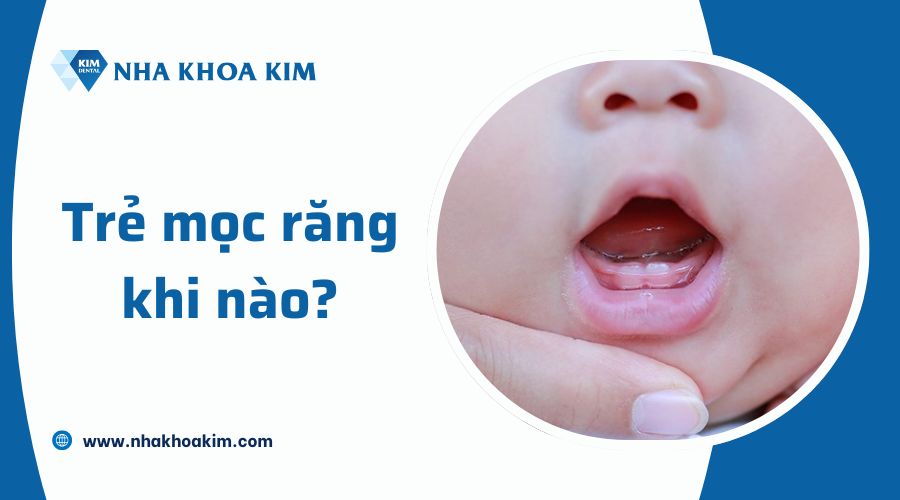 Trẻ chậm mọc răng là như thế nào?