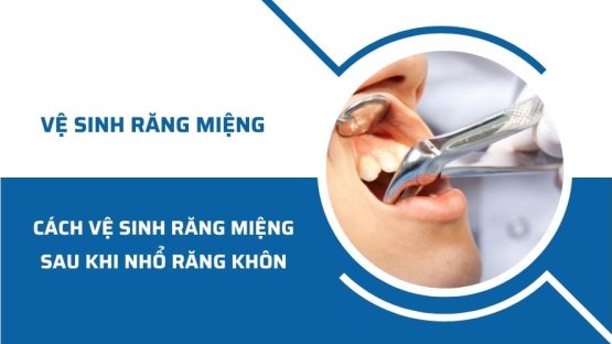 Hướng dẫn cách vệ sinh răng miệng sau khi nhổ răng khôn