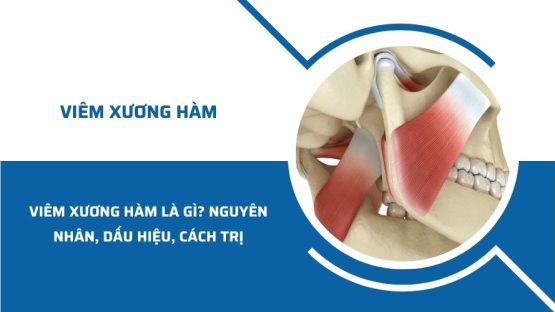 Viêm xương hàm là gì? Nguyên nhân, dấu hiệu và cách trị