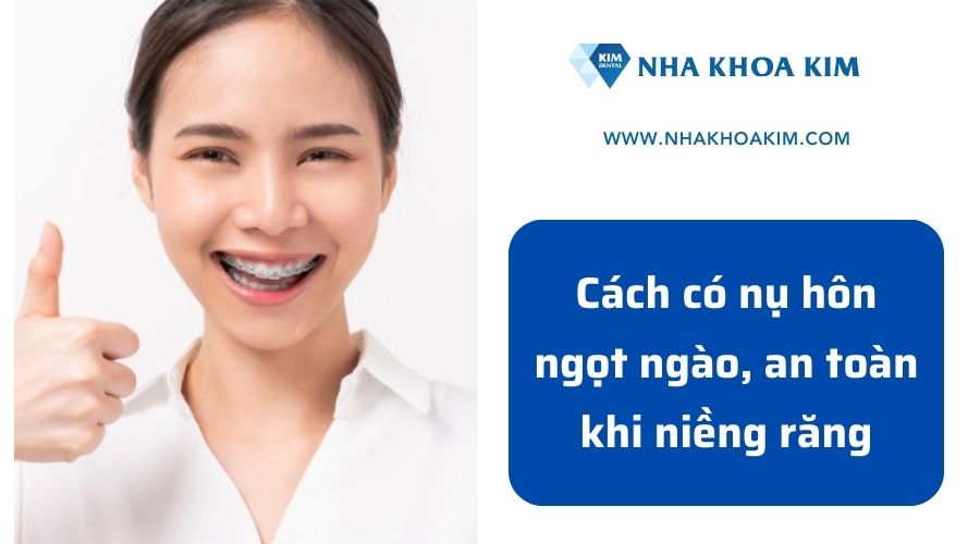 Niềng răng khi nào được hôn nhau