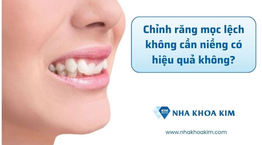 Chỉnh răng mọc lệch không cần niềng có hiệu quả không?
