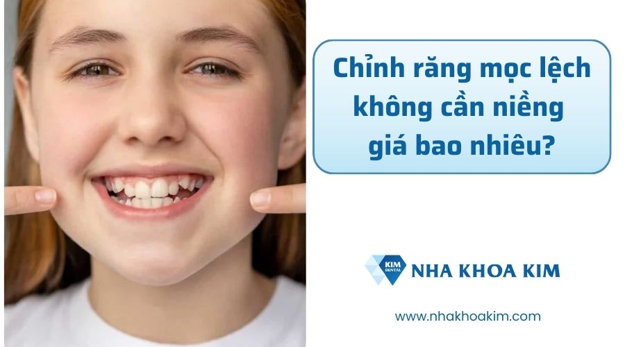 Chỉnh răng mọc lệch không cần niềng giá bao nhiêu?