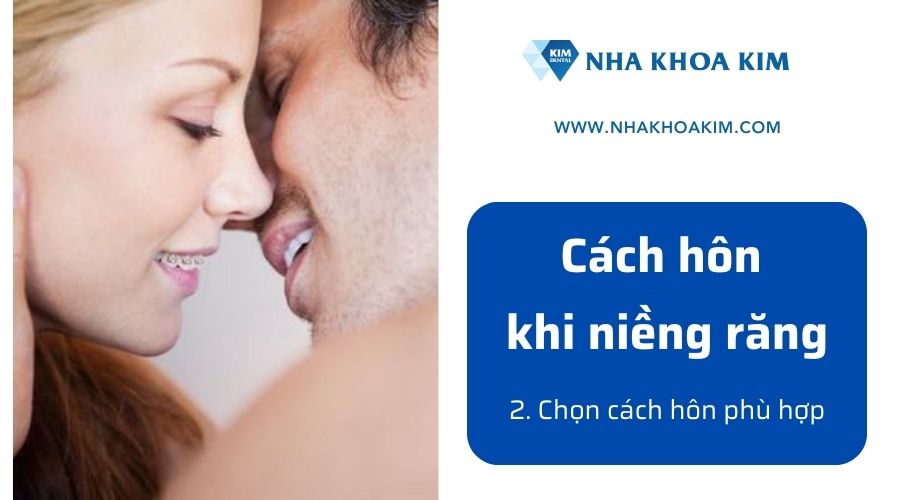 Hướng dẫn cách hôn nhau khi niềng răng