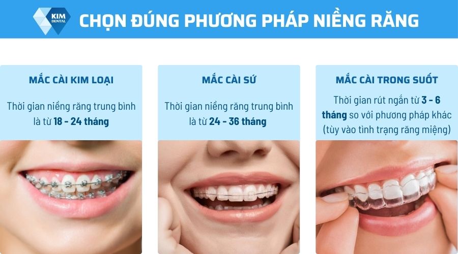 Chọn đúng phương pháp niềng răng