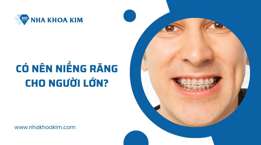 Có nên niềng răng cho người lớn tuổi không?