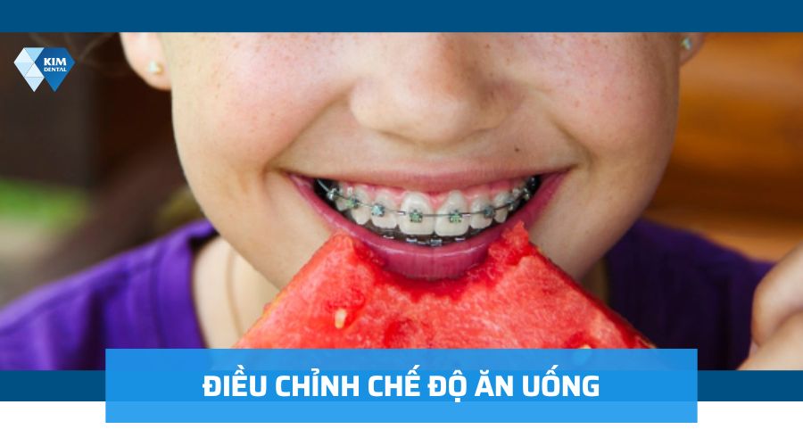 Chế độ ăn khoa học giúp rút ngắn thời gian niềng răng