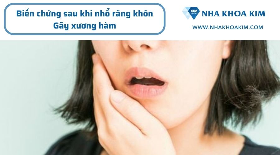 Biến chứng khi nhổ răng khôn sai quy trình