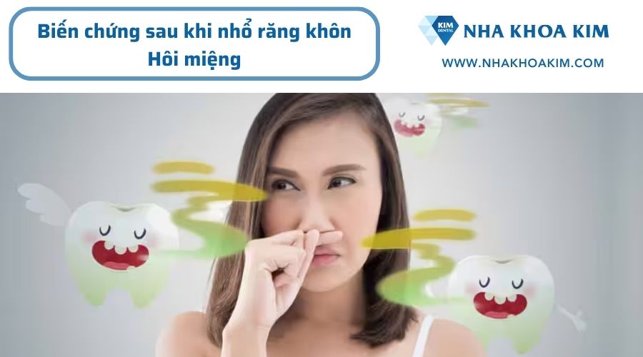 Biến chứng sau khi nhổ răng khôn hàm dưới