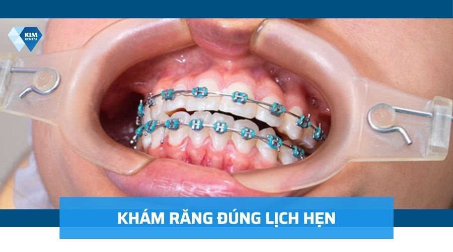 Tham khám và tuân thủ theo đúng các chỉ định của bác sĩ