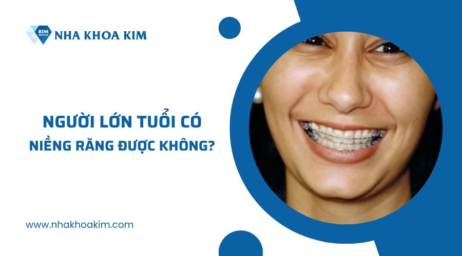 Người lớn tuổi niềng răng được không?