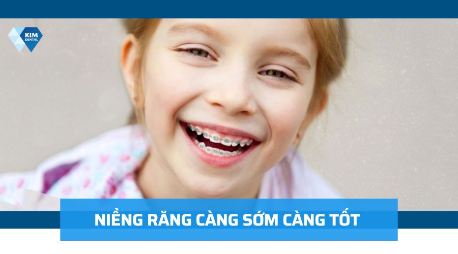 Niềng răng càng sớm càng tốt
