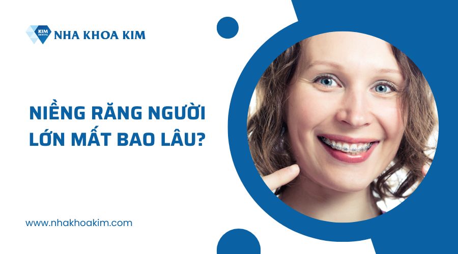 Niềng răng người lớn tuổi mất bao lâu?