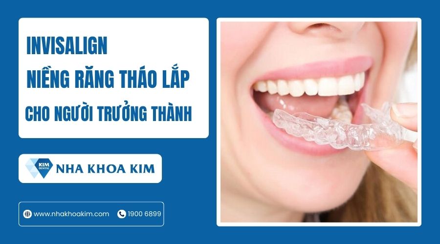 Phương pháp niềng răng tháo lắp cho người lớn