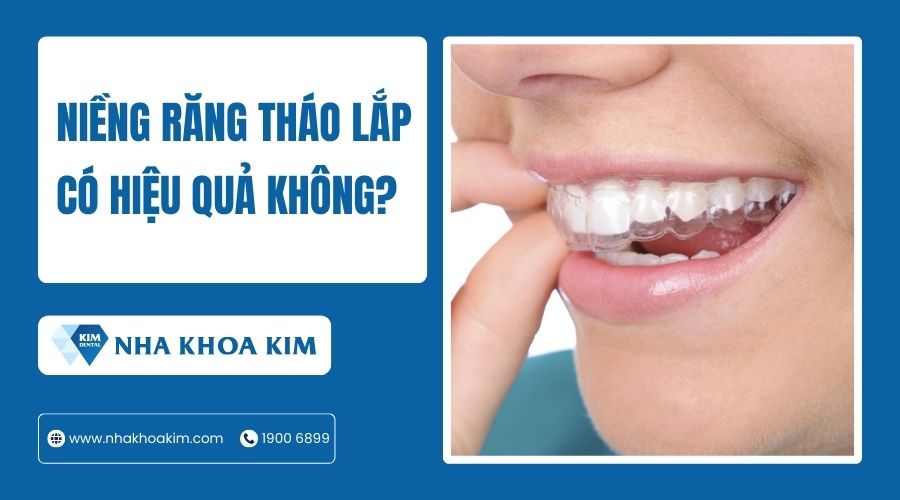 Niềng răng tháo lắp có hiệu quả không?