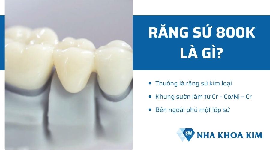 Răng sứ 800k là răng sứ gì?
